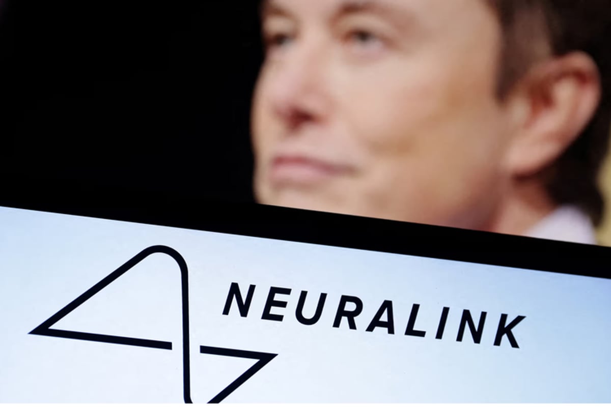 Implan Otak Neuralink Elon Musk Bermasalah, Kok Bisa?
